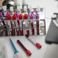 OZNACZENIE PANELU BIOCHEMICZNEGO Z KRWII KAPILARNEJ