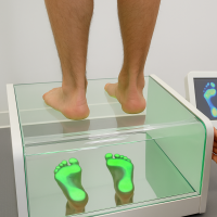 PODOSKOP - OCENA WYSKLEPIENIA STÓP